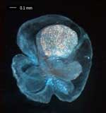 Pilidium
